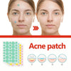 Facial Acne Remover Pimple Patch Face Skin Care Freckle Mask Beauty Health Acne 144pcs Pimple Treatment Scar Beauty Patches C8T1