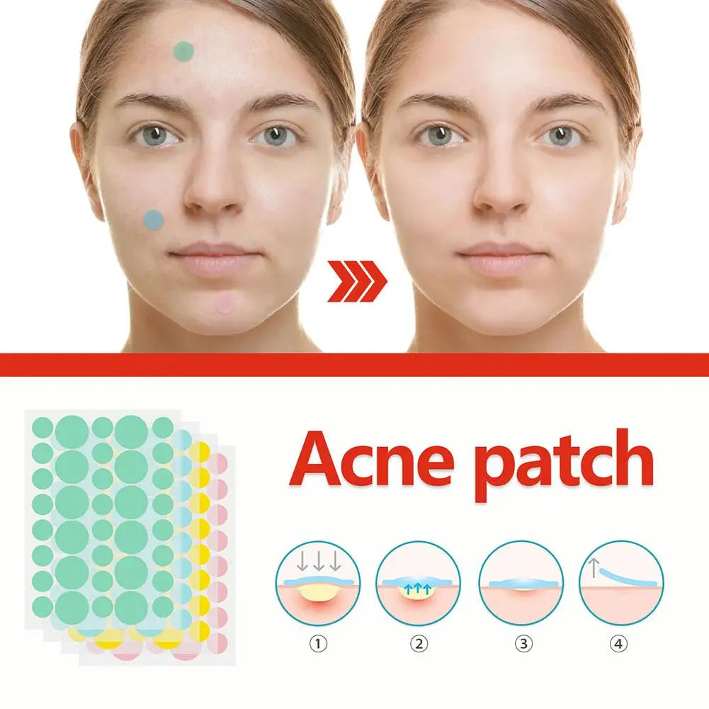 Facial Acne Remover Pimple Patch Face Skin Care Freckle Mask Beauty Health Acne 144pcs Pimple Treatment Scar Beauty Patches C8T1