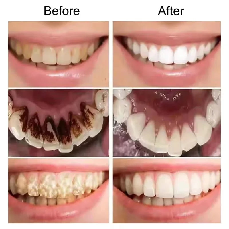 V34 Purple Teeth Whitening Toothpaste Remove Plaque Stains Cleaning Oral Hygiene Dental Bleach Tools Fresh Breath Beauty Health