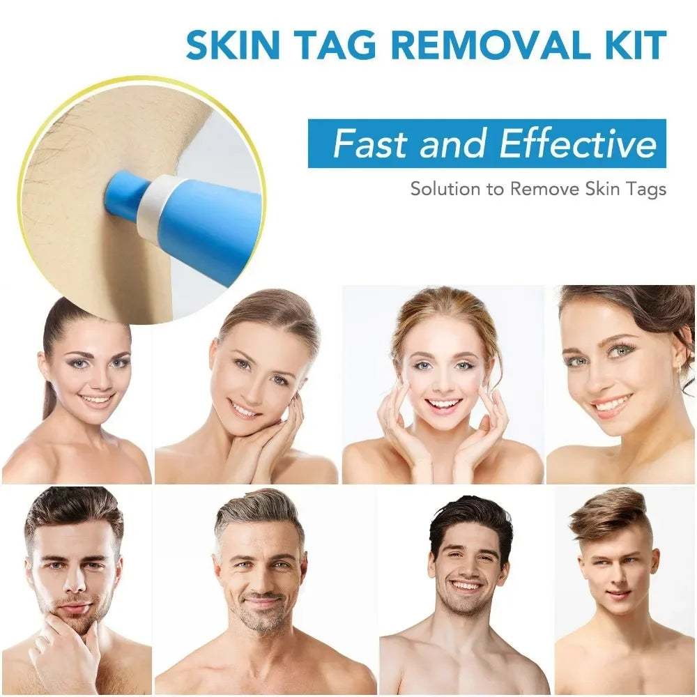 2-In-1 Painless Auto Skin Tag Mole Wart Removal Kit Cleaning Tools Face Skin Care Body Wart Dot Treatments Remover Beauty Health