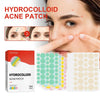 Facial Acne Remover Pimple Patch Face Skin Care Freckle Mask Beauty Health Acne 144pcs Pimple Treatment Scar Beauty Patches C8T1